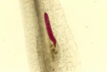 Meloidogyne Arenaria